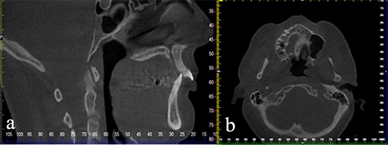 https://cdn.ncbi.nlm.nih.gov/pmc/blobs/4f65/5750831/f8b2d7ffcdf4/jiufd-051-s076-e004.jpg
