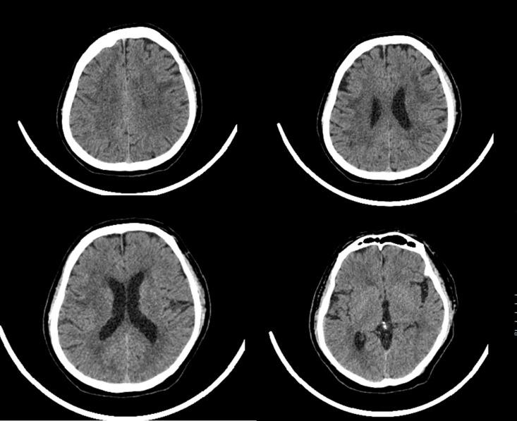 https://cdn.ncbi.nlm.nih.gov/pmc/blobs/4f66/11626645/4ae61a365ffe/gr1.jpg