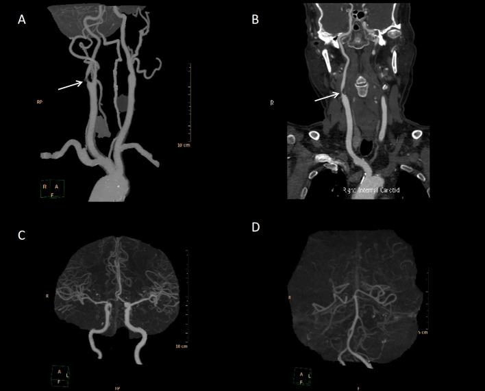 https://cdn.ncbi.nlm.nih.gov/pmc/blobs/4f66/11626645/89b62688a724/gr2.jpg