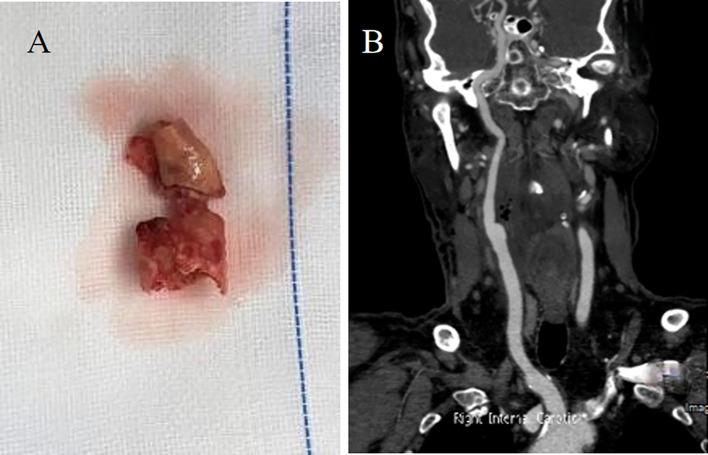 https://cdn.ncbi.nlm.nih.gov/pmc/blobs/4f66/11626645/fc016d81edd9/gr5.jpg