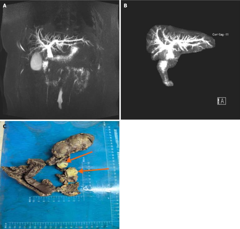 https://cdn.ncbi.nlm.nih.gov/pmc/blobs/4f6a/11995319/ba23e7a7389b/100497-g002.jpg