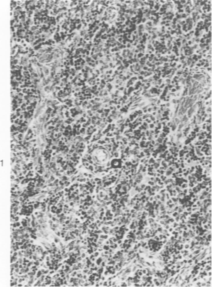 https://cdn.ncbi.nlm.nih.gov/pmc/blobs/4f72/2018582/31cde0502fc2/amjpathol00735-0040-a.jpg