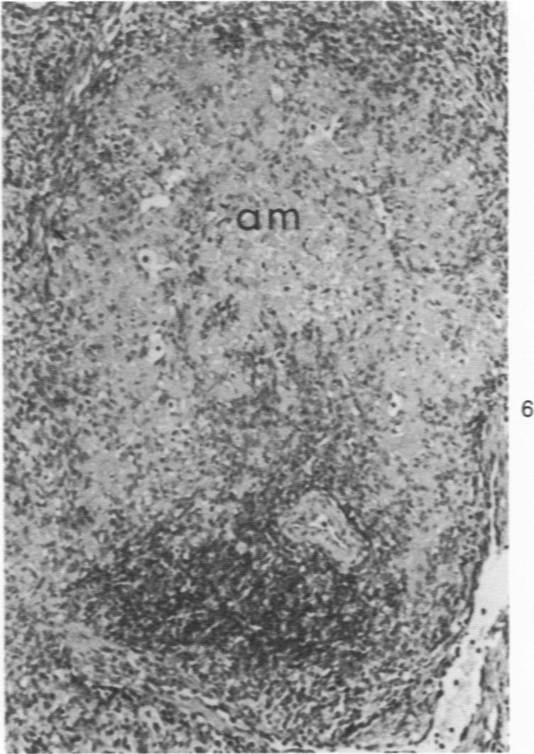 https://cdn.ncbi.nlm.nih.gov/pmc/blobs/4f72/2018582/34e9e9455467/amjpathol00735-0042-b.jpg
