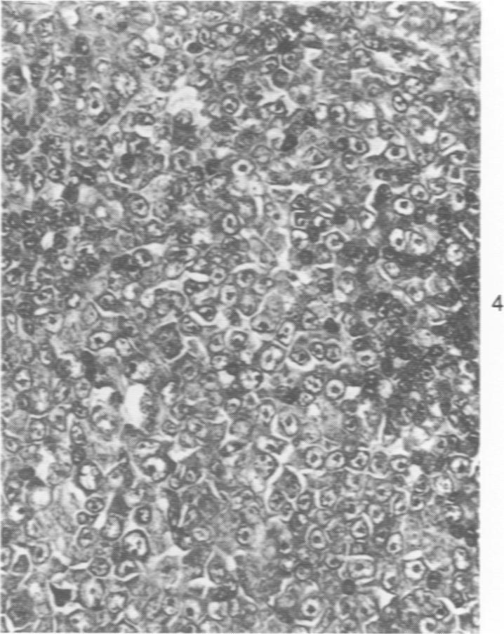 https://cdn.ncbi.nlm.nih.gov/pmc/blobs/4f72/2018582/812924f83ad2/amjpathol00735-0040-d.jpg