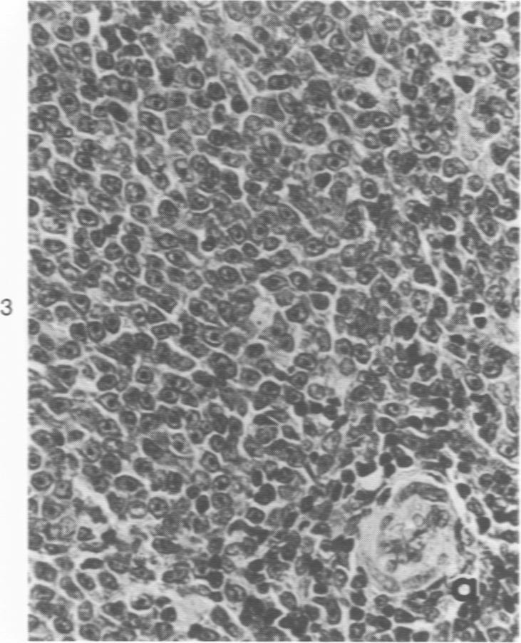 https://cdn.ncbi.nlm.nih.gov/pmc/blobs/4f72/2018582/8807e97251c3/amjpathol00735-0040-c.jpg