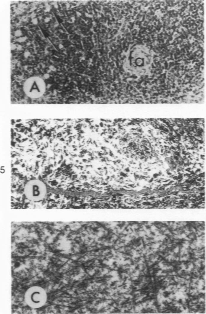 https://cdn.ncbi.nlm.nih.gov/pmc/blobs/4f72/2018582/c3f87b53e2fb/amjpathol00735-0042-a.jpg