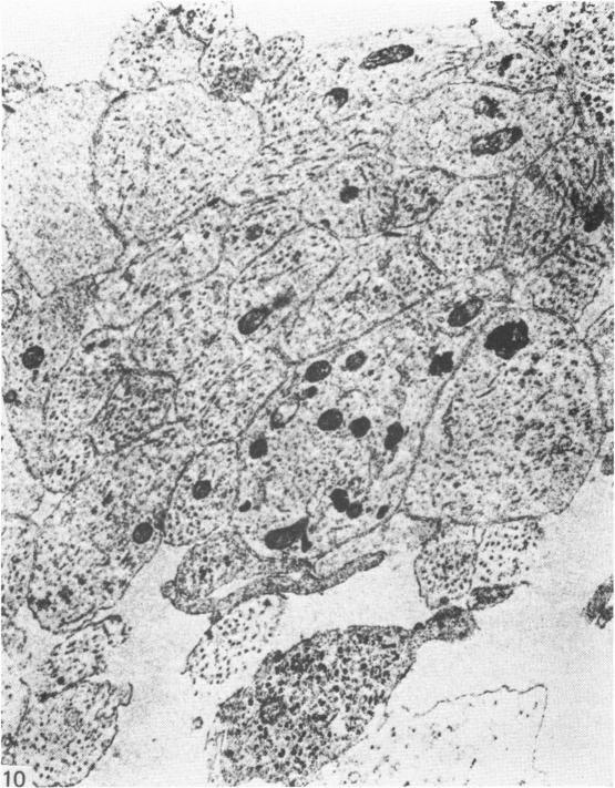 https://cdn.ncbi.nlm.nih.gov/pmc/blobs/4f7b/1167871/cc52c38a42d9/janat00220-0168-a.jpg