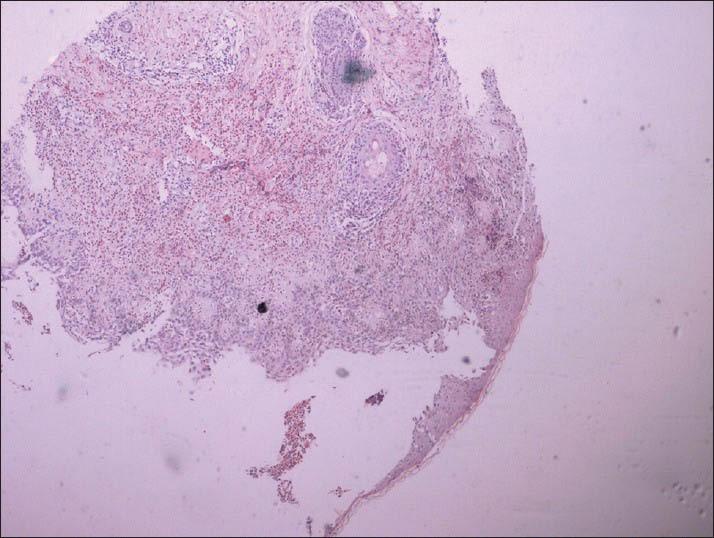 https://cdn.ncbi.nlm.nih.gov/pmc/blobs/4f7d/3969700/a4c257f307e2/IJD-59-210a-g005.jpg