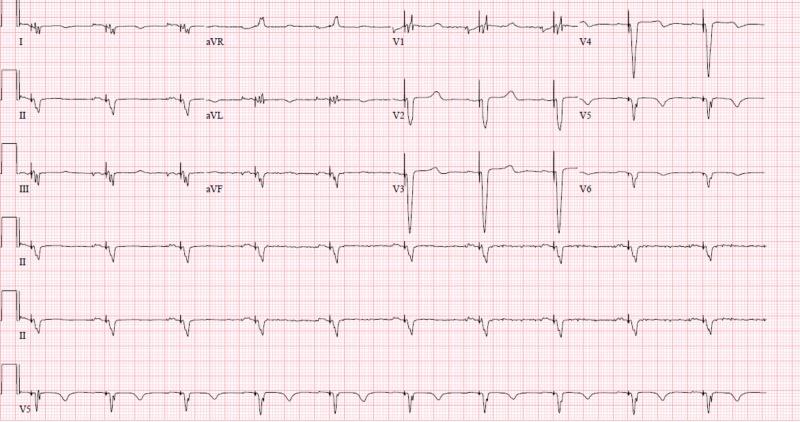 https://cdn.ncbi.nlm.nih.gov/pmc/blobs/4f7d/6464292/4556bd857b58/cureus-0011-00000004060-i01.jpg