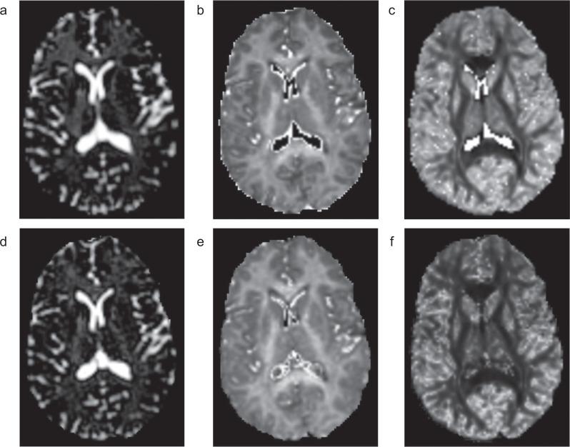 https://cdn.ncbi.nlm.nih.gov/pmc/blobs/4f7f/9199979/baa0c56b5d18/mrms-21-132-g4.jpg