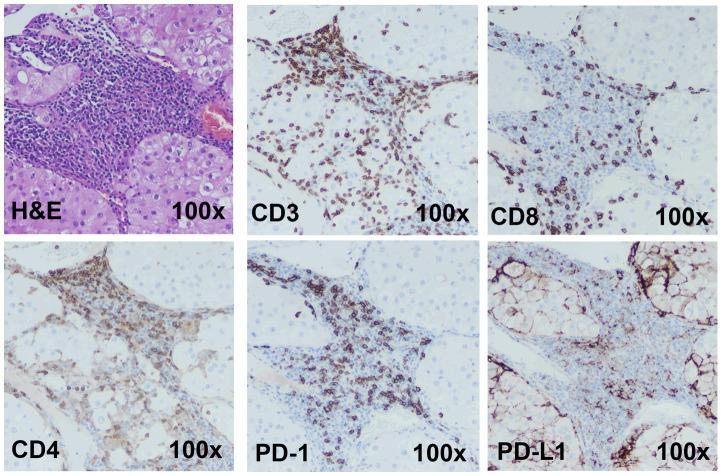https://cdn.ncbi.nlm.nih.gov/pmc/blobs/4f80/11007648/0bbea9747476/fimmu-15-1356144-g002.jpg