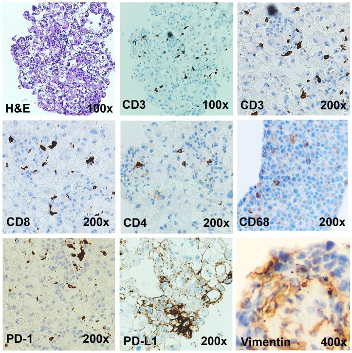 https://cdn.ncbi.nlm.nih.gov/pmc/blobs/4f80/11007648/5d4baefdb057/fimmu-15-1356144-g003.jpg