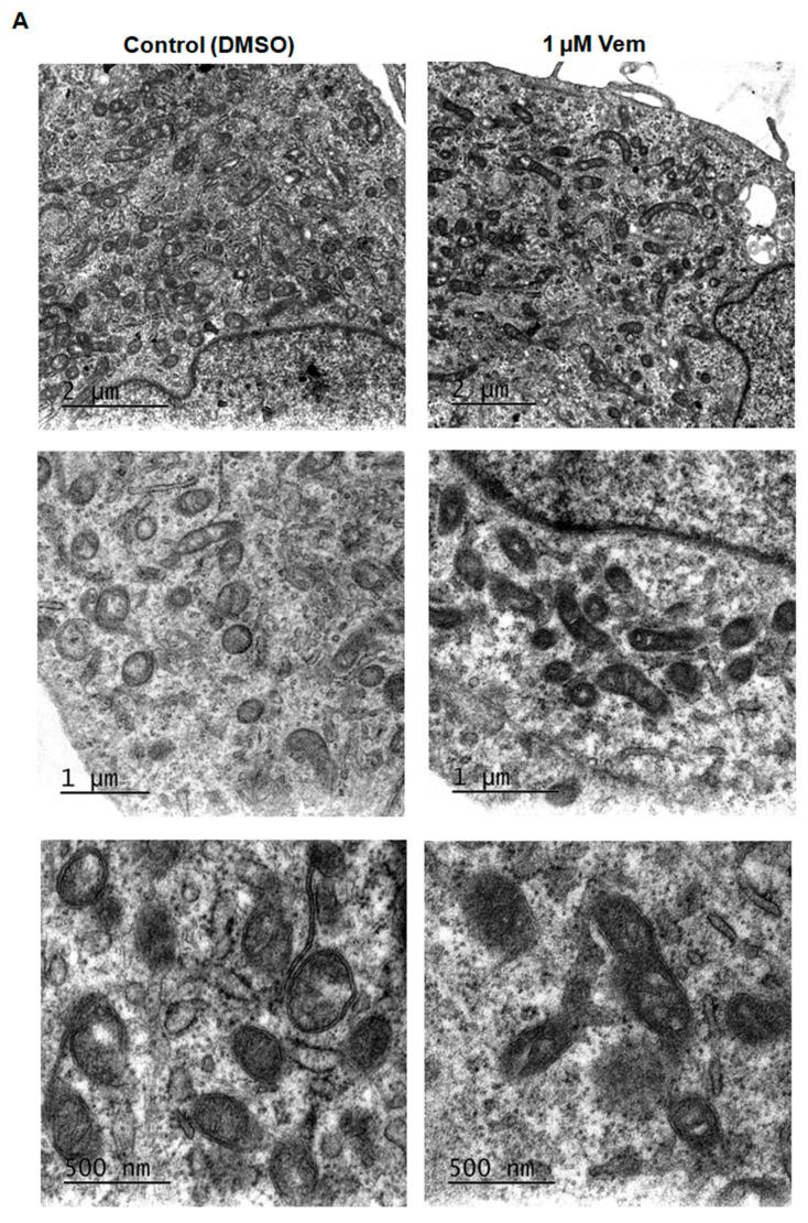 https://cdn.ncbi.nlm.nih.gov/pmc/blobs/4f82/11942190/67a084dc150d/ijms-26-02675-g002a.jpg