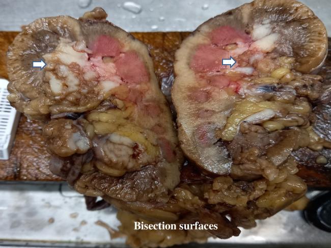https://cdn.ncbi.nlm.nih.gov/pmc/blobs/4f84/10783217/0ad37c7e70b2/ms9-86-456-g004.jpg