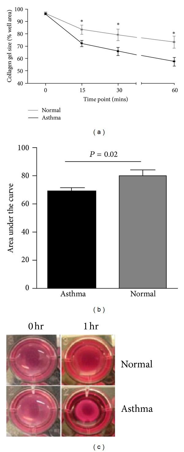 https://cdn.ncbi.nlm.nih.gov/pmc/blobs/4f87/3613096/4ca4c36978e7/JA2013-185971.001.jpg