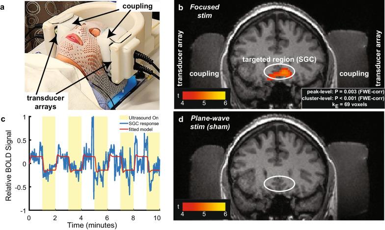 https://cdn.ncbi.nlm.nih.gov/pmc/blobs/4f8a/10612153/8a48f669c703/13256_2023_4194_Fig1_HTML.jpg