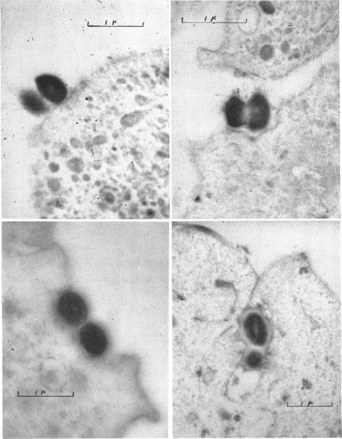 https://cdn.ncbi.nlm.nih.gov/pmc/blobs/4f8c/357851/f13eef428d8e/jbacter00534-0072-a.jpg