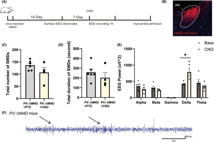 https://cdn.ncbi.nlm.nih.gov/pmc/blobs/4f8d/10472414/fa3de463280b/EPI4-8-1002-g002.jpg