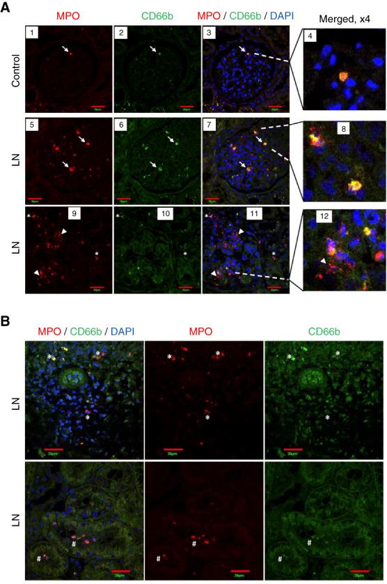 https://cdn.ncbi.nlm.nih.gov/pmc/blobs/4f90/11371349/0e621d5d0b02/kidney360-5-1154-g007.jpg