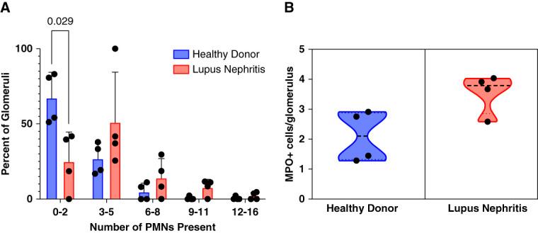 https://cdn.ncbi.nlm.nih.gov/pmc/blobs/4f90/11371349/5dd1645451e2/kidney360-5-1154-g008.jpg