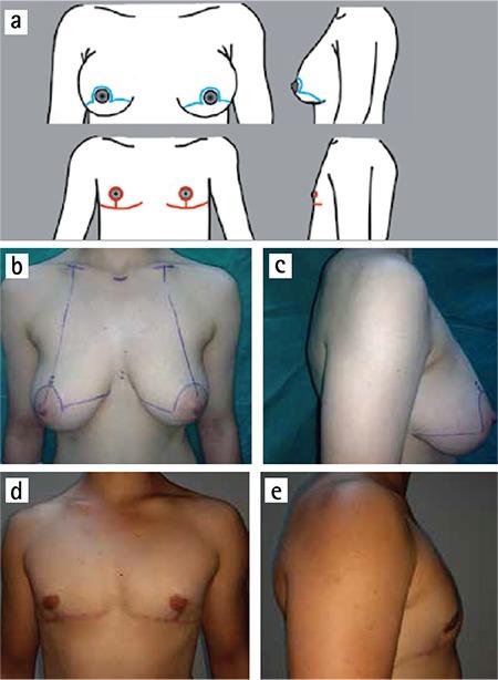 https://cdn.ncbi.nlm.nih.gov/pmc/blobs/4f93/5394296/4301cbb7ed3c/BMJ-34-147-g7.jpg