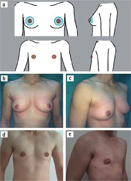 https://cdn.ncbi.nlm.nih.gov/pmc/blobs/4f93/5394296/6a589800e14e/BMJ-34-147-g5.jpg