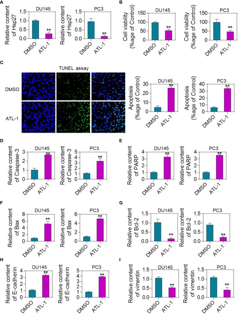 https://cdn.ncbi.nlm.nih.gov/pmc/blobs/4f9a/9853281/c5050176e91d/fonc-12-1084884-g004.jpg