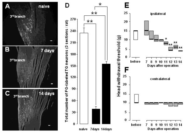 https://cdn.ncbi.nlm.nih.gov/pmc/blobs/4f9f/2829527/53cb2e87ade3/1744-8069-6-9-1.jpg