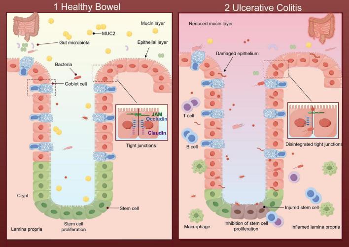 https://cdn.ncbi.nlm.nih.gov/pmc/blobs/4fa8/11975877/3542f8ac0e02/fmed-12-1569328-g001.jpg