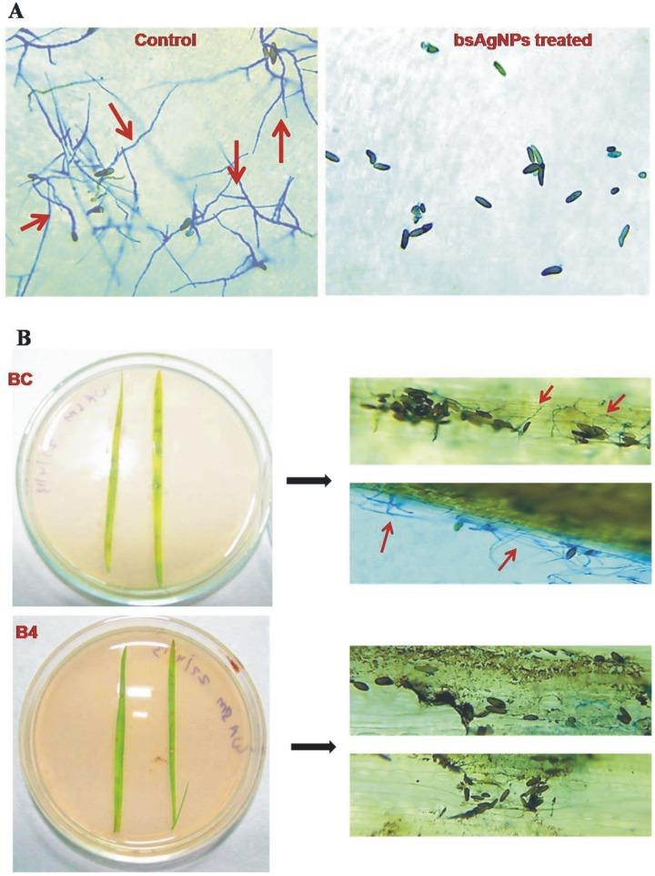 https://cdn.ncbi.nlm.nih.gov/pmc/blobs/4fae/4026416/5d2a753c0116/pone.0097881.g005.jpg