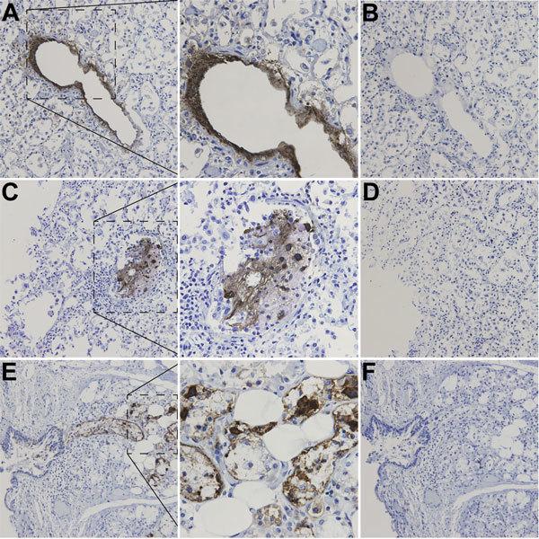 https://cdn.ncbi.nlm.nih.gov/pmc/blobs/4fb0/4696717/620814766ff2/15-1384-F2.jpg