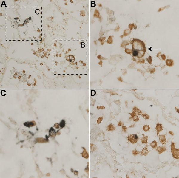 https://cdn.ncbi.nlm.nih.gov/pmc/blobs/4fb0/4696717/cb4c461ce428/15-1384-F3.jpg
