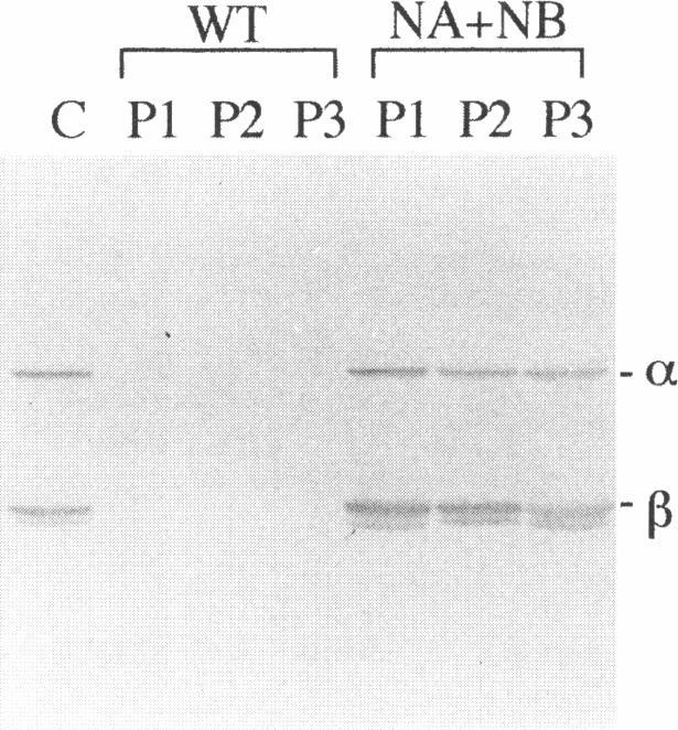 https://cdn.ncbi.nlm.nih.gov/pmc/blobs/4fb1/1914631/098594a9337a/ajhg00018-0089-c.jpg