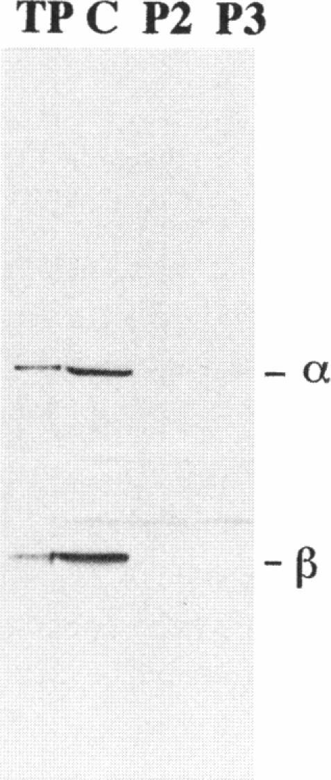 https://cdn.ncbi.nlm.nih.gov/pmc/blobs/4fb1/1914631/1bfa20ff28db/ajhg00018-0085-a.jpg