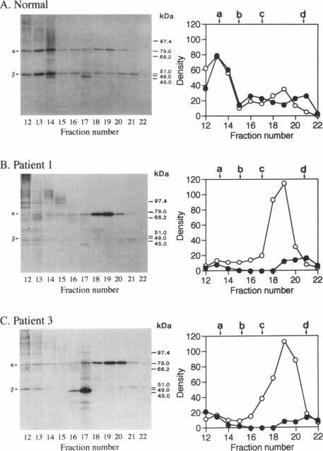 https://cdn.ncbi.nlm.nih.gov/pmc/blobs/4fb1/1914631/e7ac0e8371ad/ajhg00018-0088-a.jpg