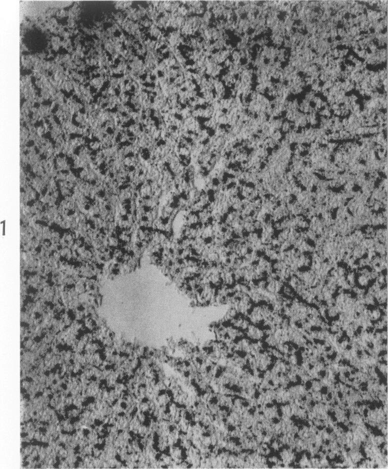 https://cdn.ncbi.nlm.nih.gov/pmc/blobs/4fb2/1949729/b951d484afb8/amjpathol00308-0091-a.jpg