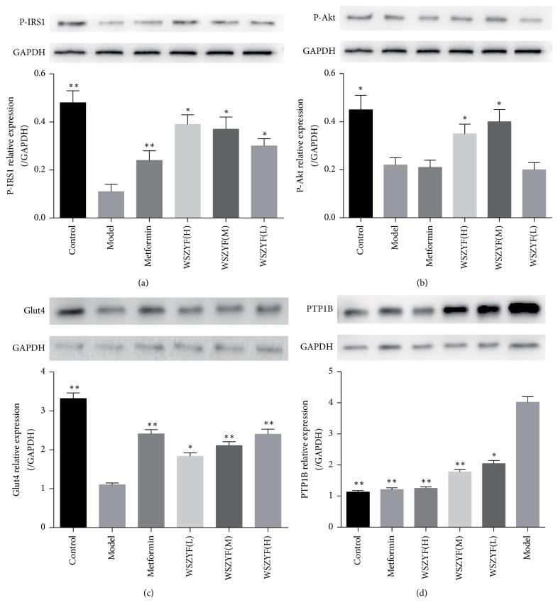 https://cdn.ncbi.nlm.nih.gov/pmc/blobs/4fb5/5804399/3ddd5d6d193b/ECAM2017-4393529.005.jpg