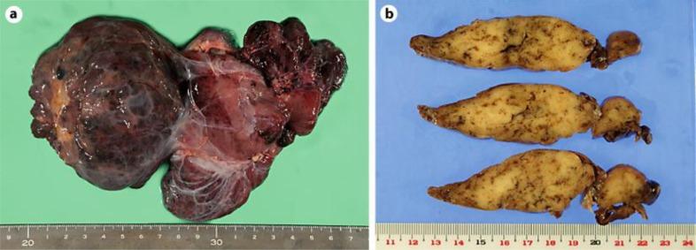 https://cdn.ncbi.nlm.nih.gov/pmc/blobs/4fbb/3398081/a67cc4e757ce/crg-0006-0375-g02.jpg