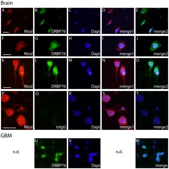 https://cdn.ncbi.nlm.nih.gov/pmc/blobs/4fbe/2909144/9502a4b627e8/pone.0011710.g002.jpg