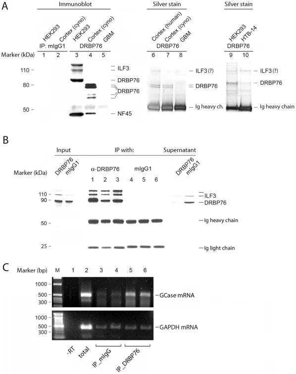 https://cdn.ncbi.nlm.nih.gov/pmc/blobs/4fbe/2909144/a113153cef02/pone.0011710.g003.jpg