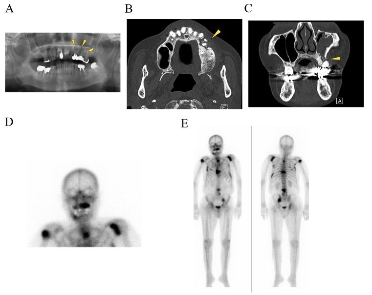 https://cdn.ncbi.nlm.nih.gov/pmc/blobs/4fc2/5494808/c6e08613c880/ol-14-01-0127-g01.jpg