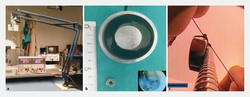 https://cdn.ncbi.nlm.nih.gov/pmc/blobs/4fc3/5876038/61d3a7605cf5/10-1055-s-0043-125364-i1074ei1.jpg