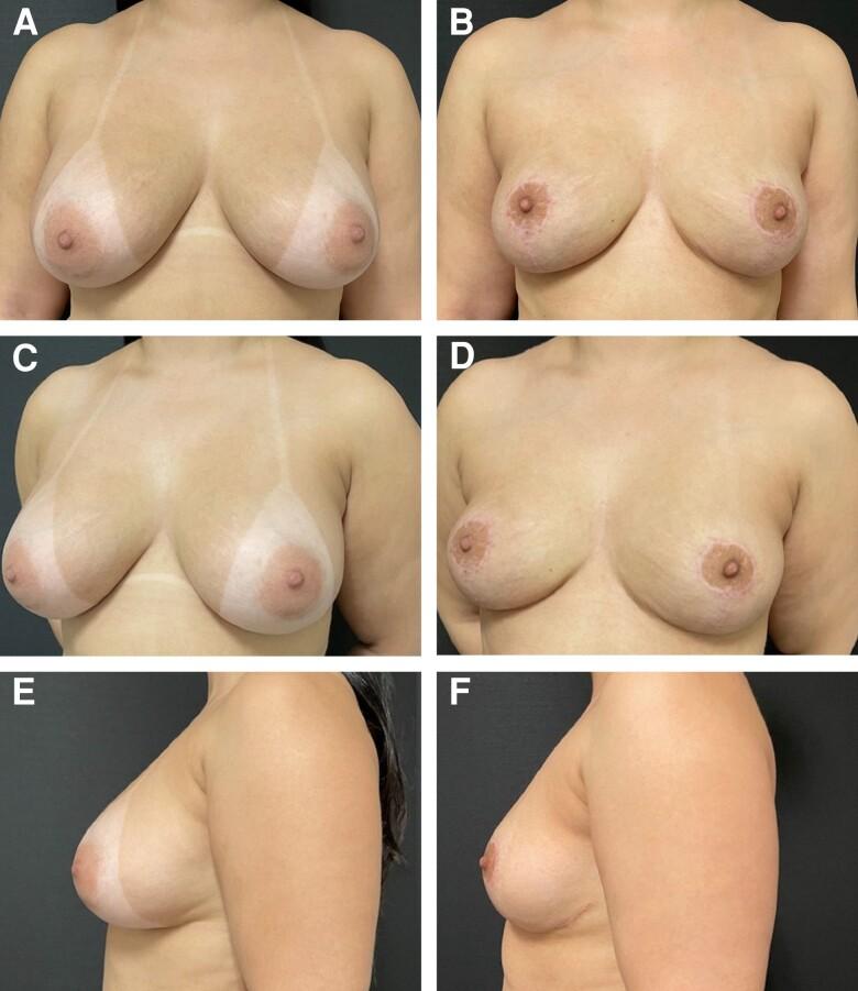 https://cdn.ncbi.nlm.nih.gov/pmc/blobs/4fce/10205400/046a3506a313/ojad037f7.jpg