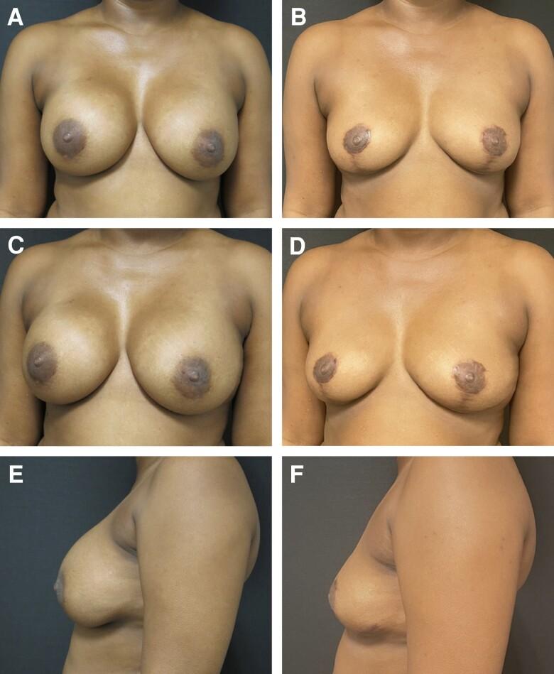 https://cdn.ncbi.nlm.nih.gov/pmc/blobs/4fce/10205400/0ade5c239c8a/ojad037f6.jpg