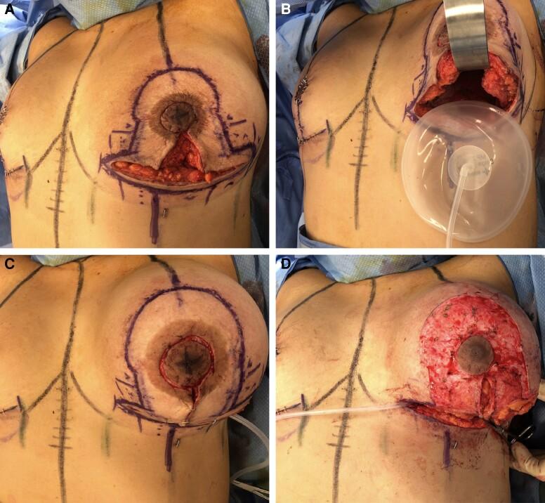 https://cdn.ncbi.nlm.nih.gov/pmc/blobs/4fce/10205400/66c391dc7b4e/ojad037f3.jpg