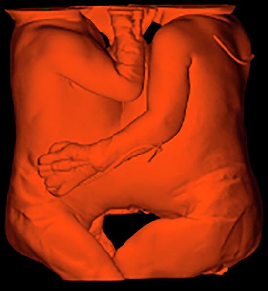 https://cdn.ncbi.nlm.nih.gov/pmc/blobs/4fd7/12081715/4f66012ce218/41746_2025_1575_Fig2_HTML.jpg