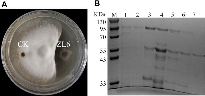 https://cdn.ncbi.nlm.nih.gov/pmc/blobs/4fd8/11180921/5247cbb44941/jmb-34-5-1040-f3.jpg
