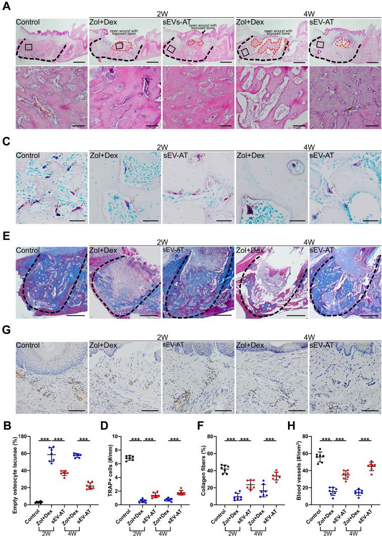 https://cdn.ncbi.nlm.nih.gov/pmc/blobs/4fe6/8114828/f172e17d84ec/IJN-16-3161-g0004.jpg