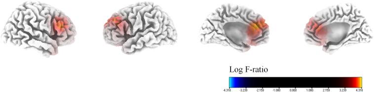 https://cdn.ncbi.nlm.nih.gov/pmc/blobs/4fe7/7221249/8c13da835079/fnins-14-00410-g003.jpg