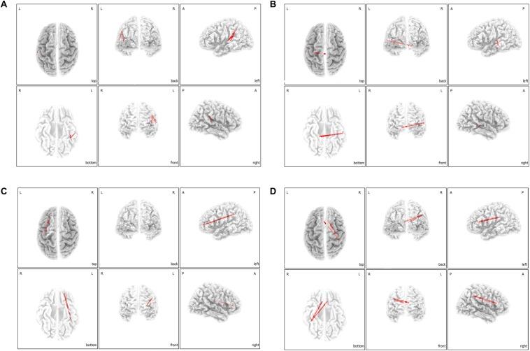 https://cdn.ncbi.nlm.nih.gov/pmc/blobs/4fe7/7221249/fb047d6465c1/fnins-14-00410-g004.jpg
